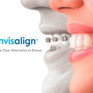 Dentista Torrelodones