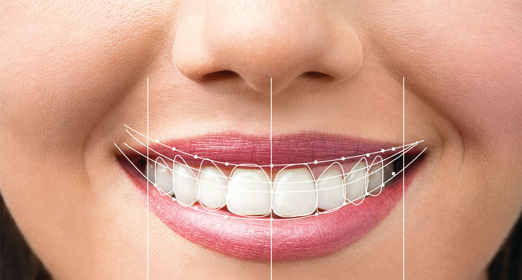 estetica dental 1 - Estética dental